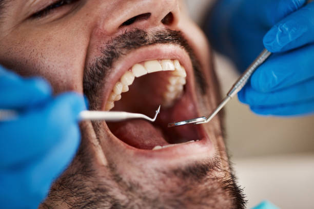 Best Emergency Gum Treatment in Lagrange, IN